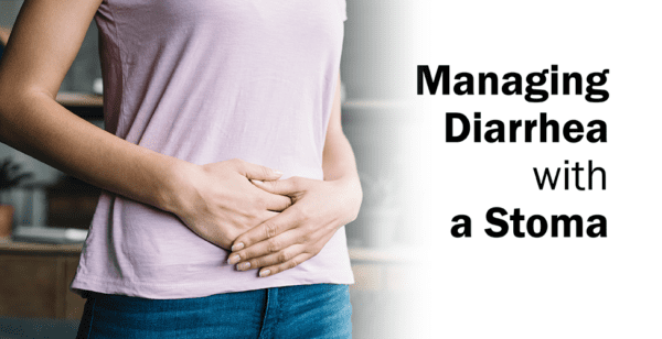 woman holding her stomach in discomfort for the blog cover of managing diarrhea with a stoma