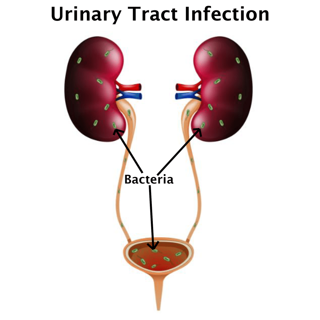 Image of the kidneys showing where to contribute to a urinary tract infectionbacteria enters