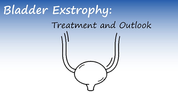 bladder exstrophy treatment and outlook