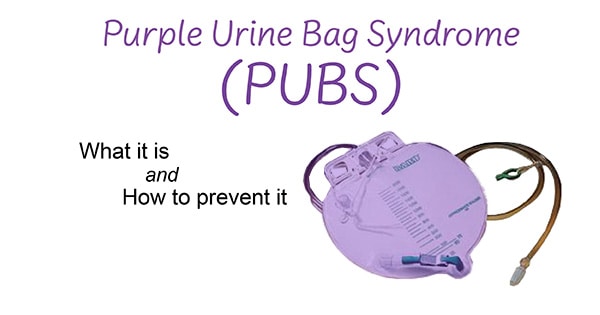 What is Purple Urine Bag Syndrome (PUBS)?