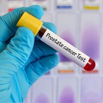 lab worker holding vile of blood marked as a prostate cancer test