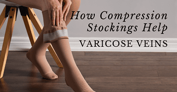 How Compression Stockings Help Varicose Veins