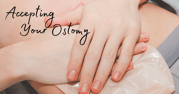 Accepting Your Ostomy