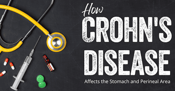 How Crohn's Disease Affects the Stomach and Perineal Area