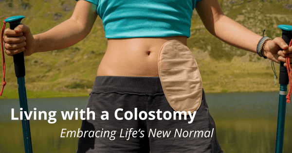 Living with a Colostomy