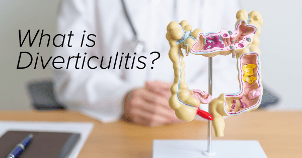 What is diverticulitis?